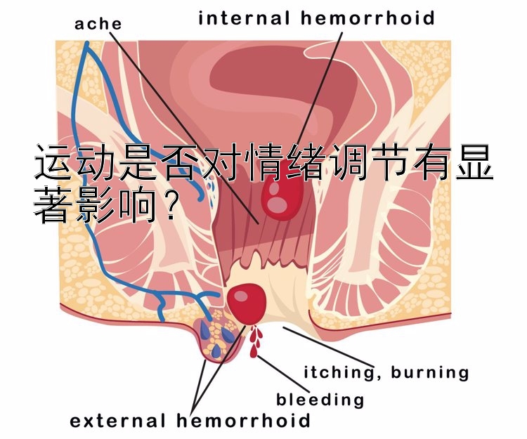 运动是否对情绪调节有显著影响？