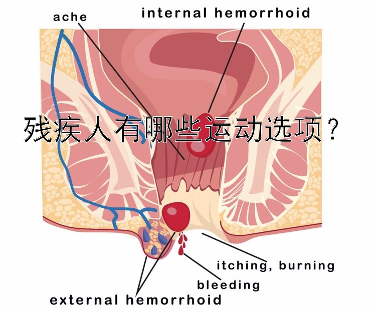 残疾人有哪些运动选项？