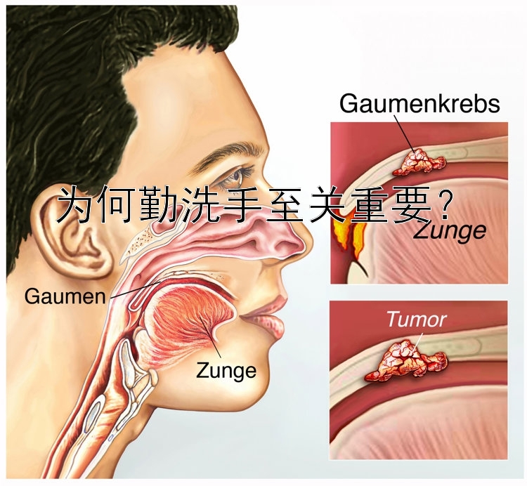 为何勤洗手至关重要？