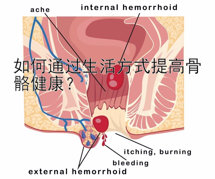 如何通过生活方式提高骨骼健康？