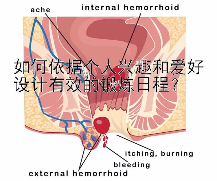 如何依据个人兴趣和爱好设计有效的锻炼日程？