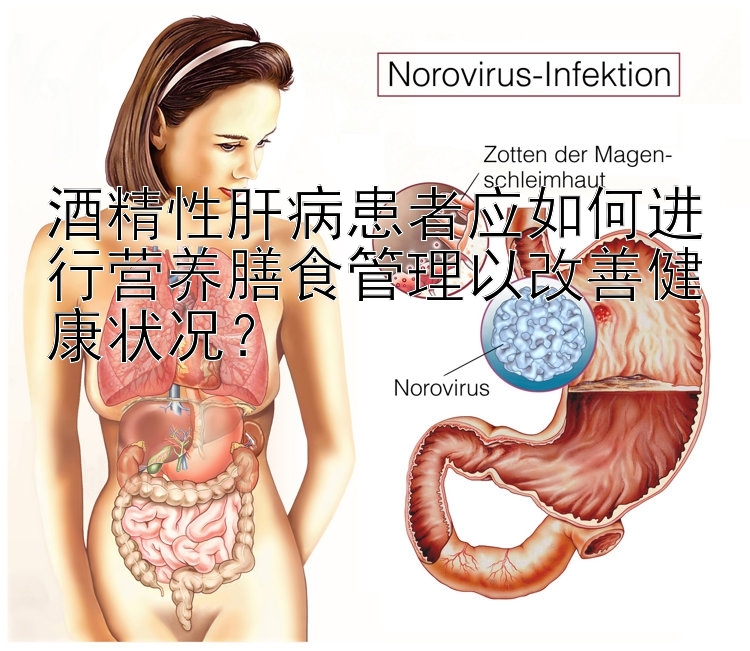 酒精性肝病患者应如何进行营养膳食管理以改善健康状况？