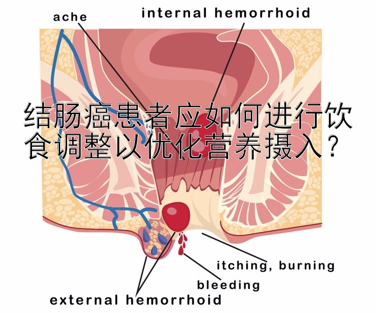 结肠癌患者应如何进行饮食调整以优化营养摄入？