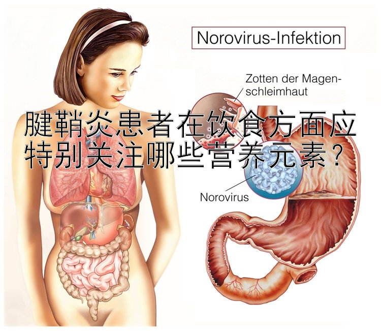 腱鞘炎患者在饮食方面应特别关注哪些营养元素？