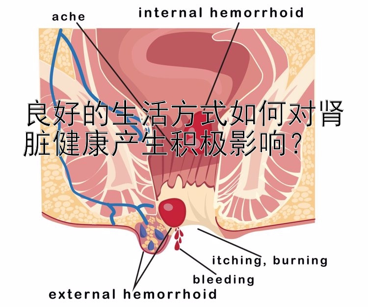 良好的生活方式如何对肾脏健康产生积极影响？