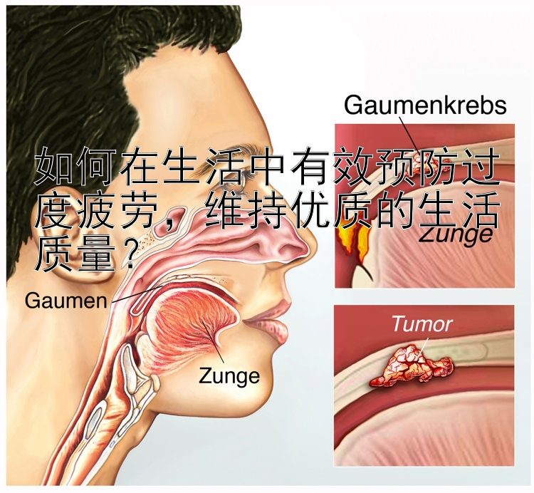 如何在生活中有效预防过度疲劳，维持优质的生活质量？