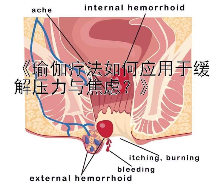 《瑜伽疗法如何应用于缓解压力与焦虑？》