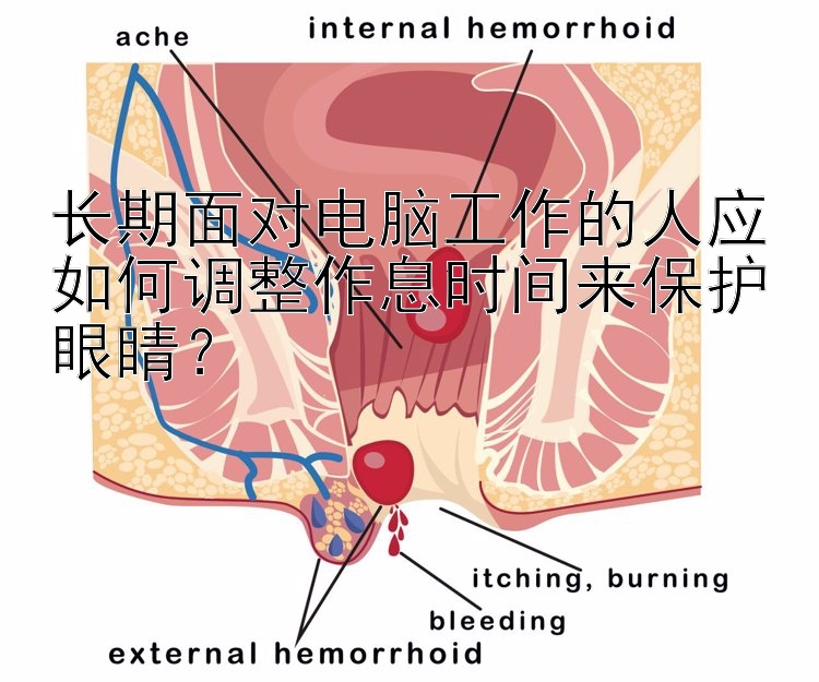 长期面对电脑工作的人应如何调整作息时间来保护眼睛？