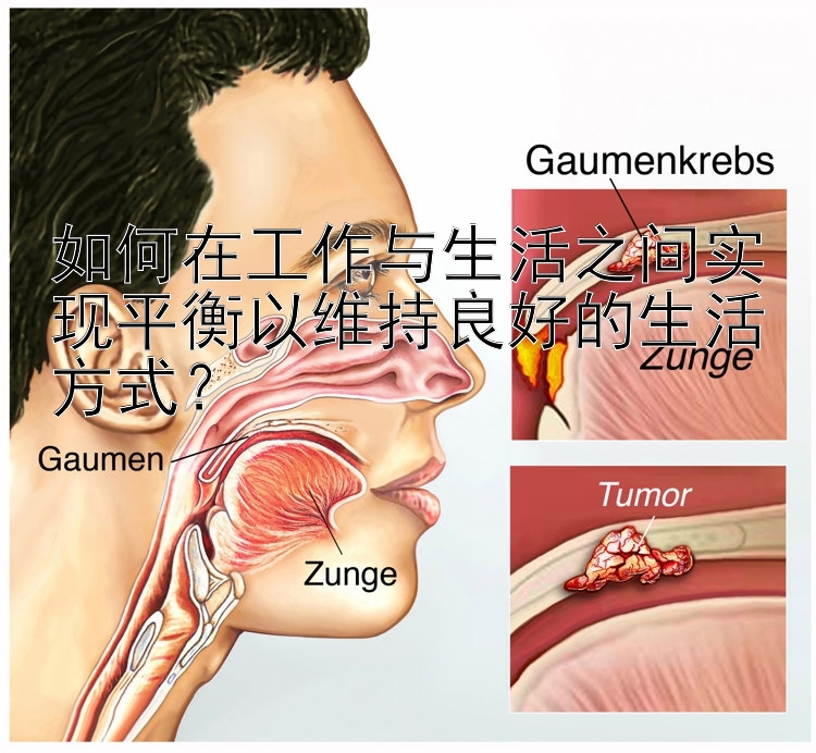 如何在工作与生活之间实现平衡以维持良好的生活方式？