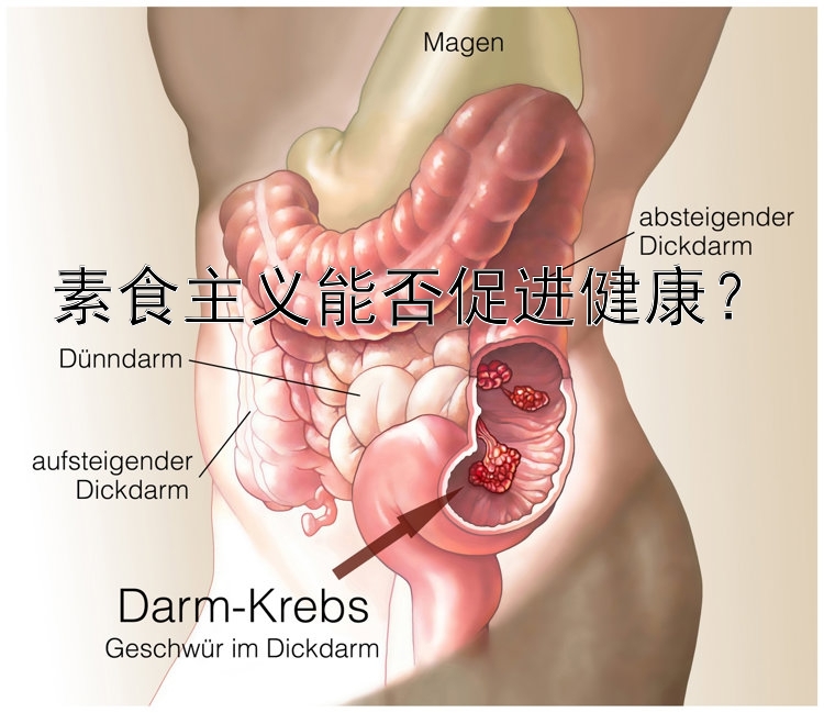 素食主义能否促进健康？