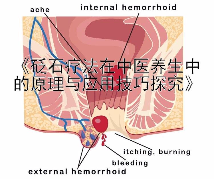 《砭石疗法在中医养生中的原理与应用技巧探究》