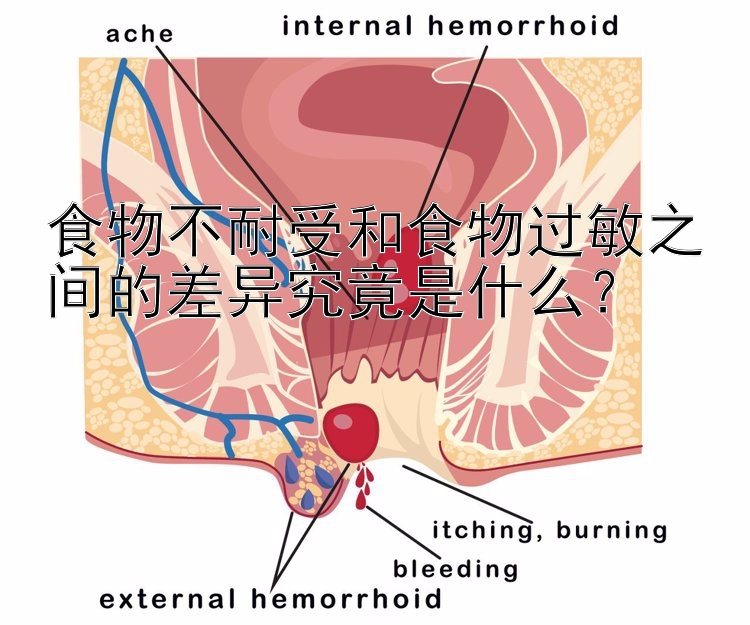 食物不耐受和食物过敏之间的差异究竟是什么？