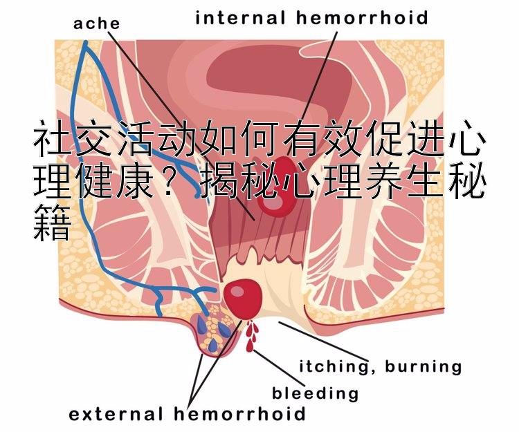 社交活动如何有效促进心理健康？揭秘心理养生秘籍