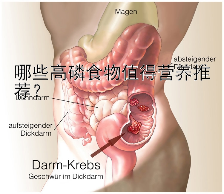 哪些高磷食物值得营养推荐？