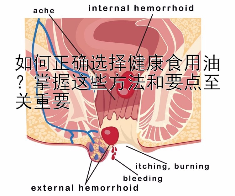 如何正确选择健康食用油？掌握这些方法和要点至关重要