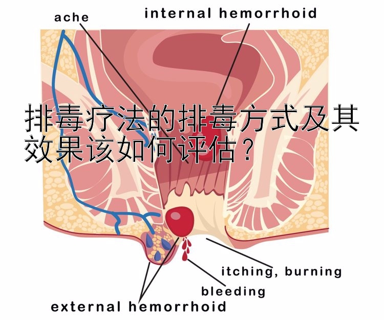 排毒疗法的排毒方式及其效果该如何评估？