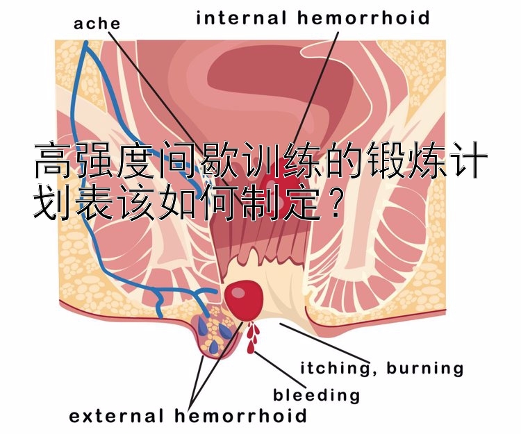 高强度间歇训练的锻炼计划表该如何制定？