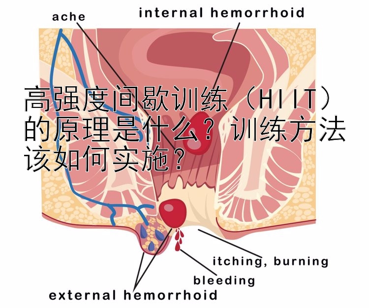 高强度间歇训练（HIIT）的原理是什么？训练方法该如何实施？