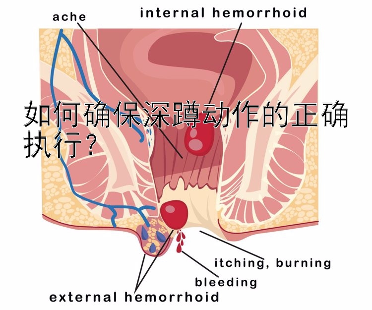 如何确保深蹲动作的正确执行？