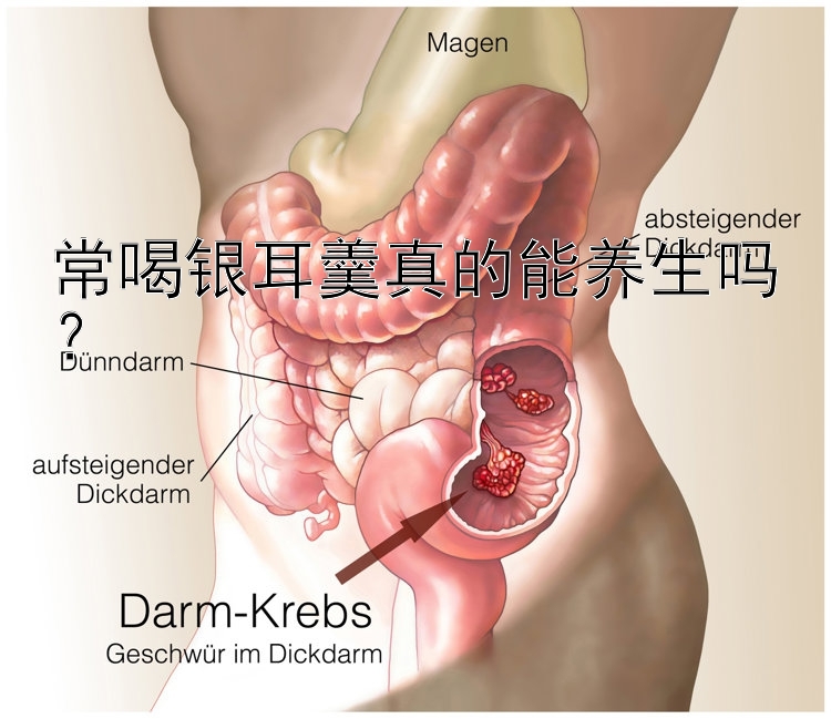 常喝银耳羹真的能养生吗？