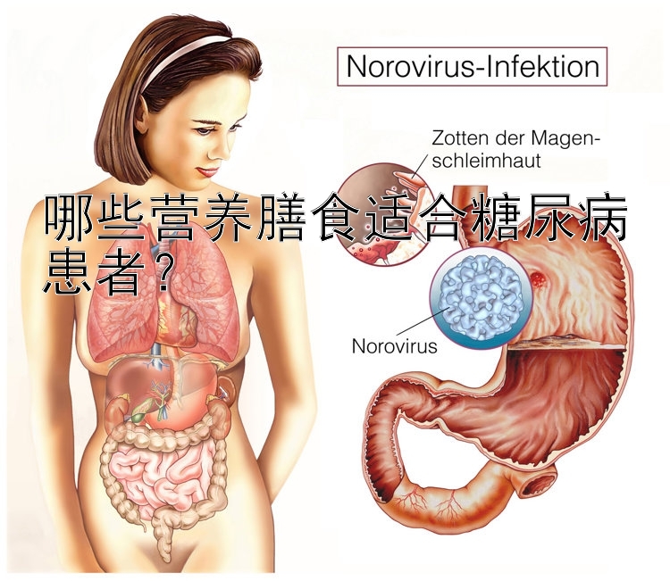 哪些营养膳食适合糖尿病患者？