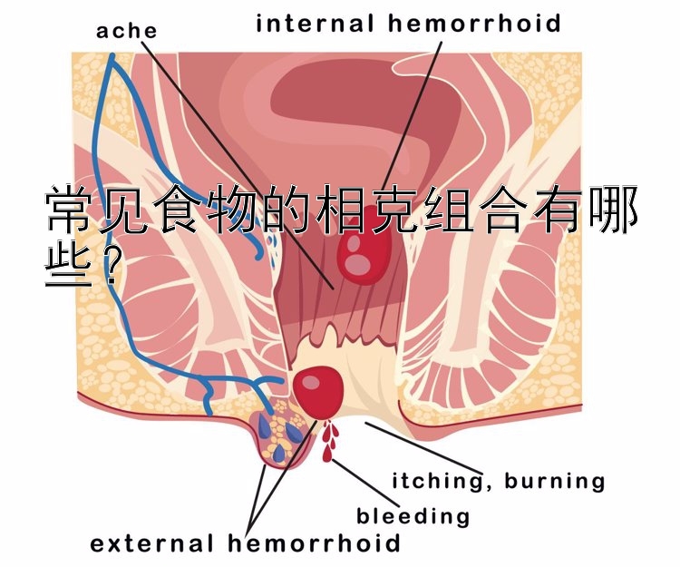 常见食物的相克组合有哪些？