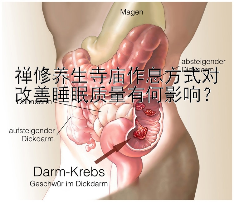 禅修养生寺庙作息方式对改善睡眠质量有何影响？