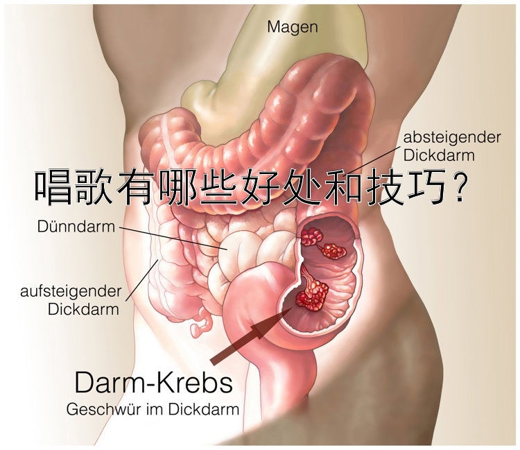 唱歌有哪些好处和技巧？