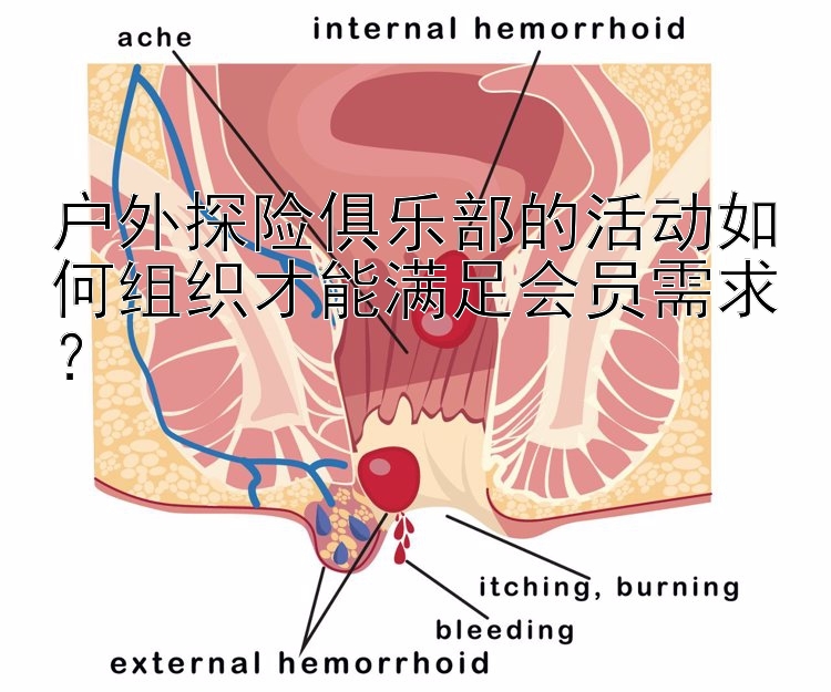 户外探险俱乐部的活动如何组织才能满足会员需求？