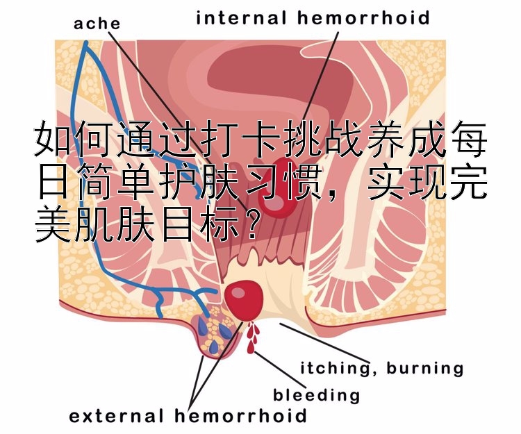 如何通过打卡挑战养成每日简单护肤习惯，实现完美肌肤目标？