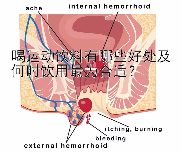 喝运动饮料有哪些好处及何时饮用最为合适？