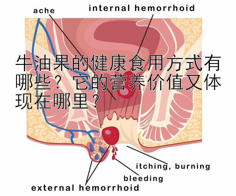 牛油果的健康食用方式有哪些？它的营养价值又体现在哪里？