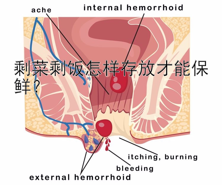 剩菜剩饭怎样存放才能保鲜？